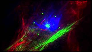 Troubled - Abstract Laser show