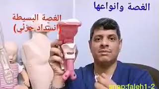 الغصه وأنواعها