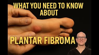 Plantar Fibroma Causes, Symptoms & Treatments At The London Podiatry Centre