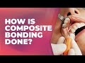 How is composite bonding done? | Cosmetic Dentist Preston