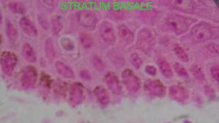 STRATUM BASALE