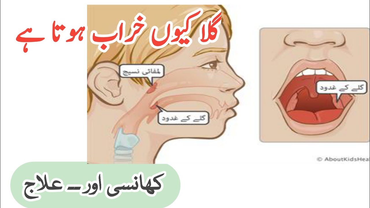 Throat infection Kyu hota hai Gala kharab kyon hota hai YouTube
