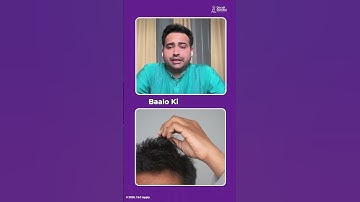 Rahu, Pitru Dosh, Past Life Karma – Kya Aapke Baalon Ki Samasya Inhi Ka Parinaam Hai?