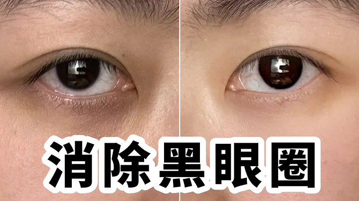 黑眼圈怪熬夜？找准原因，教你3分钟告别黑眼圈！ - 天天要闻