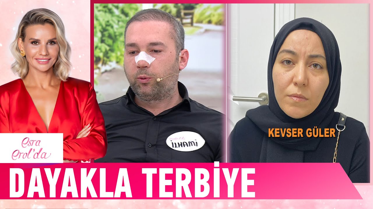 Kayınbiraderim 15 yaşındaki kızımı darp etti!  - Esra Erol'da Kolaj