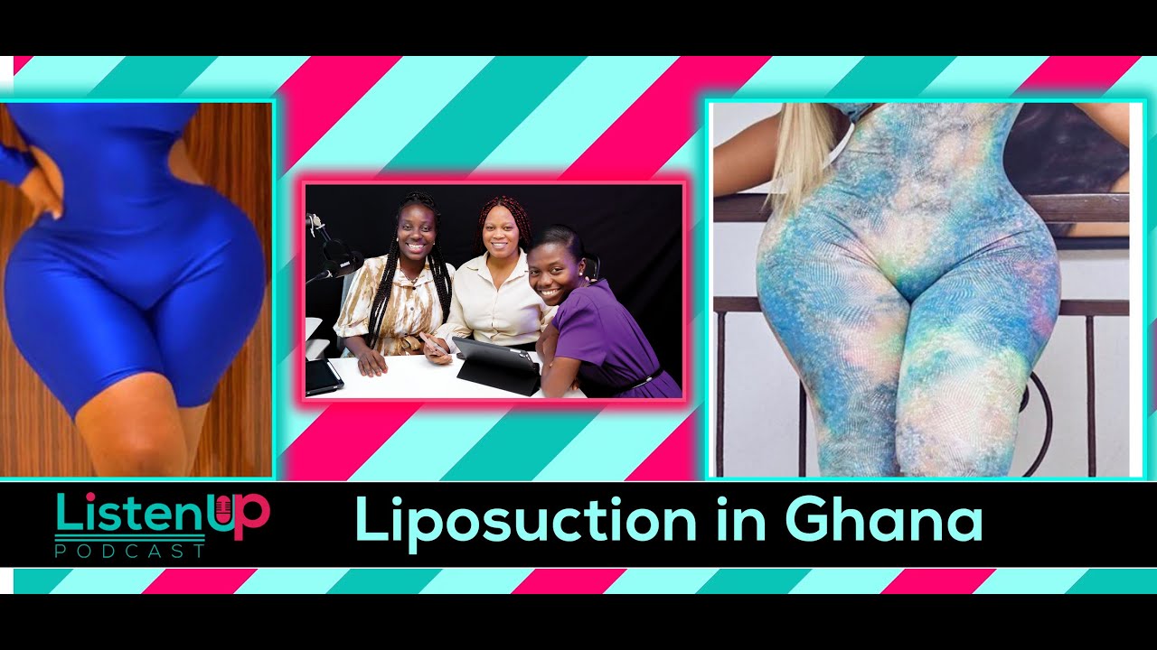 Liposuction and “body maintenance” in Ghana | ListenUp Podcast