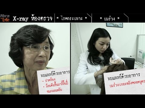 ศิริราช The Life [by Mahidol] ซีรีส์ x-ray ห้องตรวจ ตอน โรคกระเพาะ และ ผมร่วง