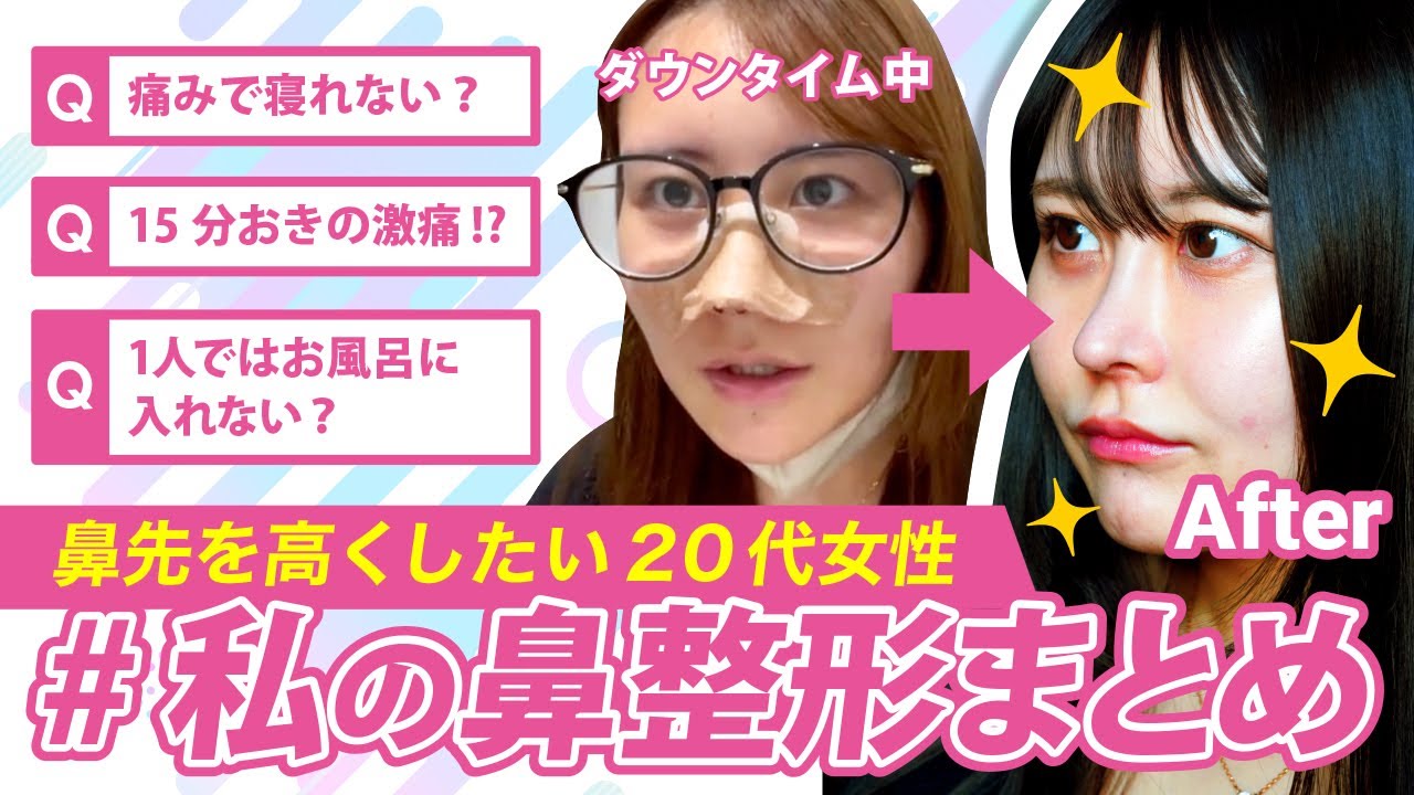 【横顔美人に！】鼻先のお悩み解決！モニターさん密着で鼻整形のリアルを大公開！