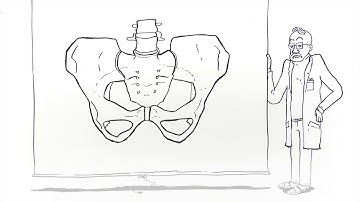 Bekkenleddsmerter (forklart av FORMI) - English subtitles