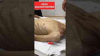 Gazze’de Hayatın Rengini Solduran Gerçek: Açlık..#gaza #shorts #açlık #gazzeölüyor #gazze #savegaza