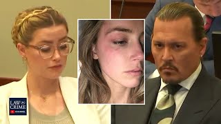 'I saw no visible injuries on Amber Heard' Police Officer Testifies