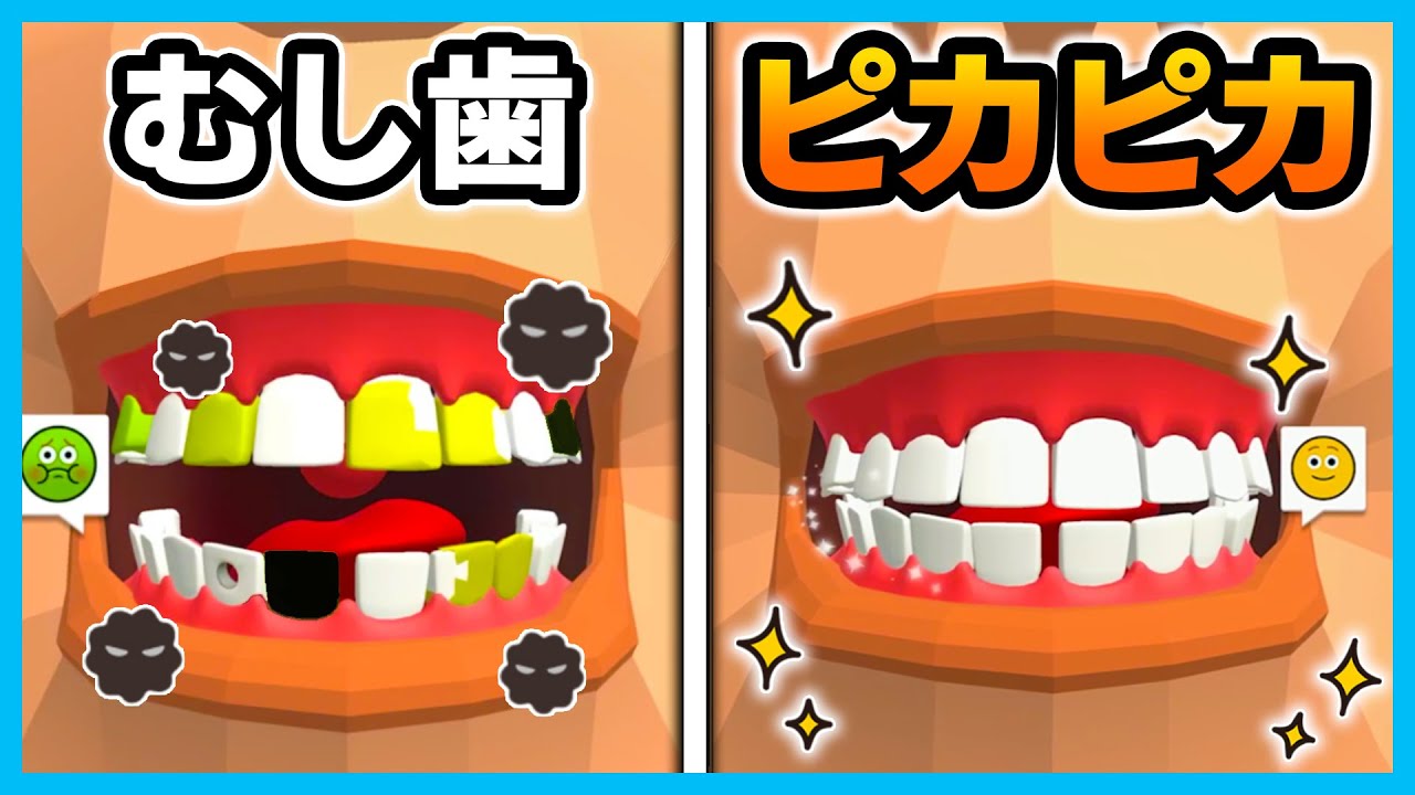 むし歯をキレイにする歯医者ゲームが楽しすぎた！？😆【Dentist Bling】【ゲーム実況】