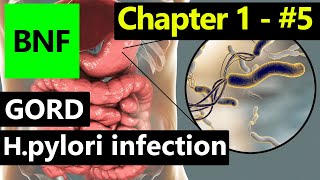 📘 BNF Chapter 1 – Part 5 | 💊 GORD & H. pylori Infection – Easy Explanation, Tests & Treatment Notes