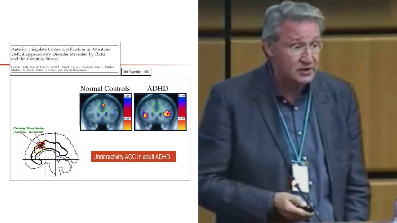Willem van den Brink - SUD & Co-occuring Attention Deficit Disorder