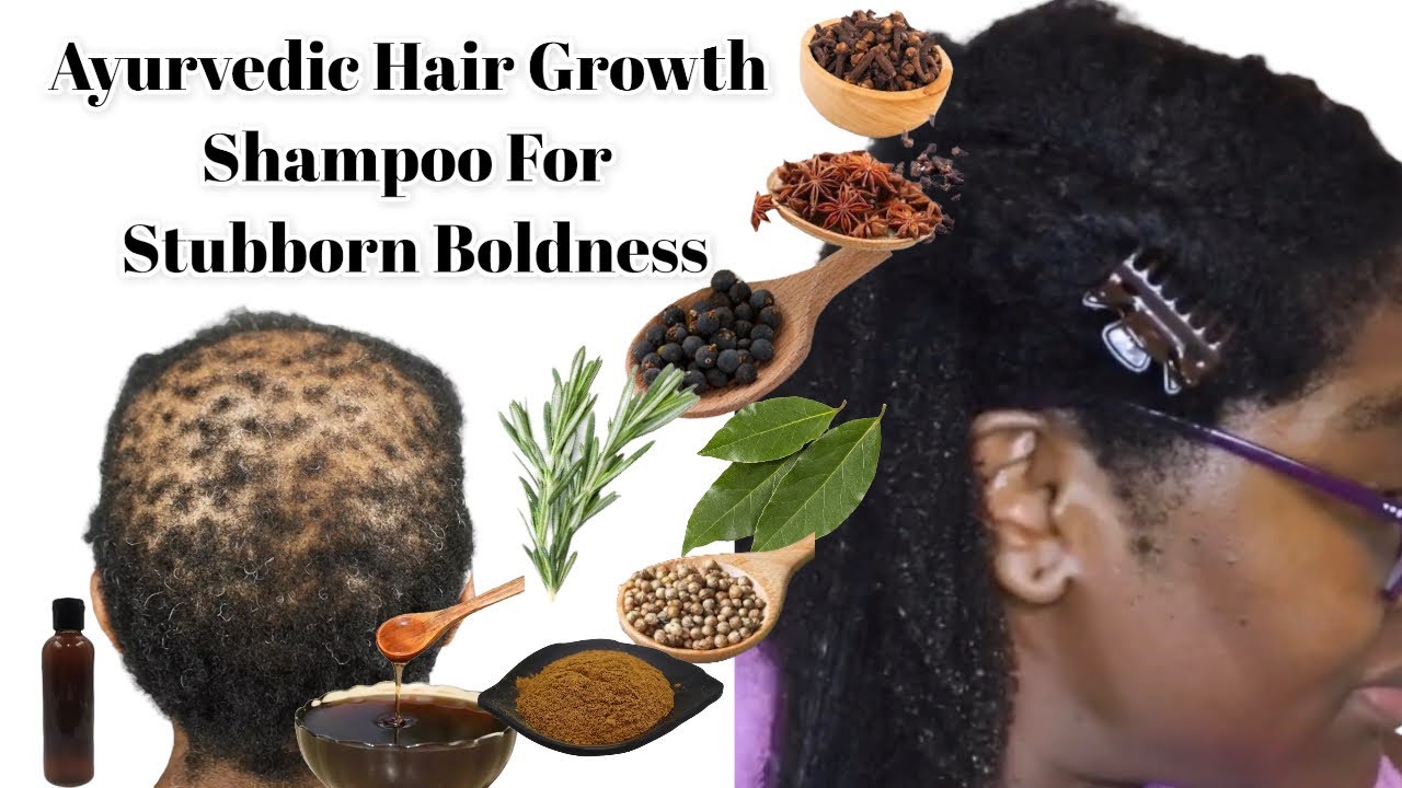 7 Herbal Shampoo To Fight Hair Loss and Baldness Safe and Effective