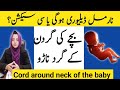 Cord Around Neck of the Baby| Is Normal Delivery possible? | Gynae guide 