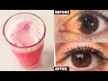DRINK FOR STRONGER VISION AND REMOVE CATARACT I How to improve your eyesight naturally fast at home