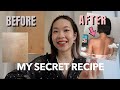 HOW I CURED MY BACK ACNE (Before/After Photos) | Euodias