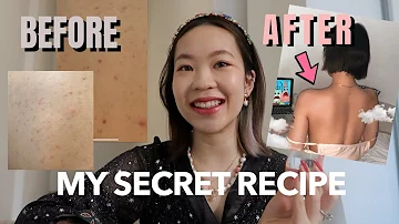 Can baths help acne?
