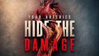 What High Cholesterol Does Inside Your Arteries