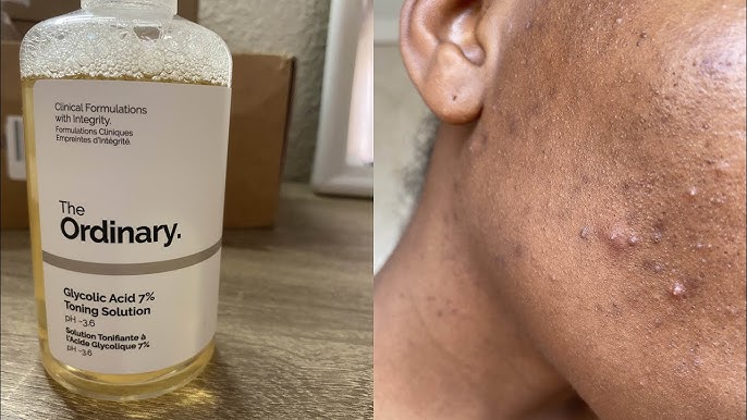 THE ORDINARY GLYCOLIC ACID 7% TONING SOLUTION