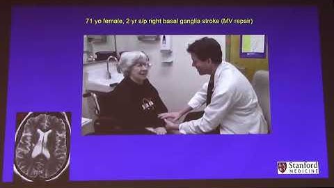 Gary Steinberg (Stanford) on "Stem cell therapy for stroke"