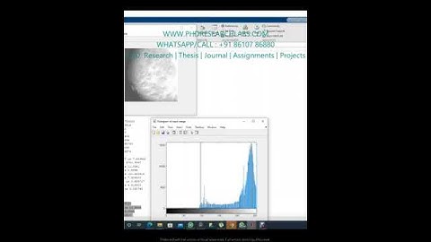 Contrast Limited Adaptive Histogram Equalization for mammography images Matllab CLAHE code - MATLAB
