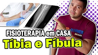 FRATURA DE TÍBIA E FÍBULA EXERCÍCIOS / PARTE 3