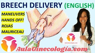 BREECH DELIVERY MANEUVERS: HANDS OFF, ROJAS, MAURICEAU... BASIC RULES. - Gynecology and Obstetrics -