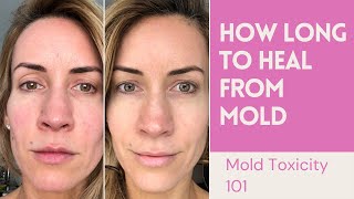 How Long To Heal From Mold?  Mold Toxicity 101