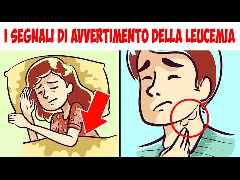 Video: Ritiro Di Prednisone: Sintomi, Trattamento E Altro