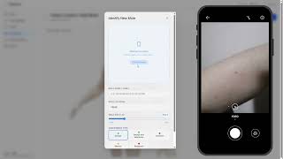 Getting Started with NeviScan: Full 3D Mole Tracking Walkthrough screenshot 3