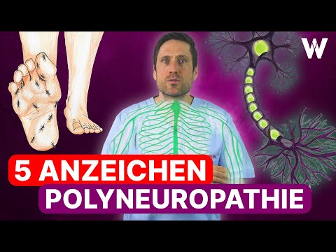 Video: 3 Möglichkeiten, Neuropathie zu vermeiden