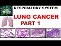 LUNG CANCER- Part 1- Epidemiology, Etiopathogenesis, Precursor lesions & Classification