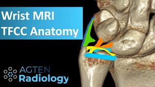 MRI Anatomy of TFCC