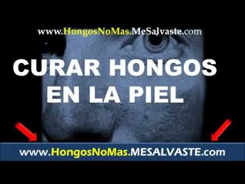como curar el hongo en la piel con remedios caseros