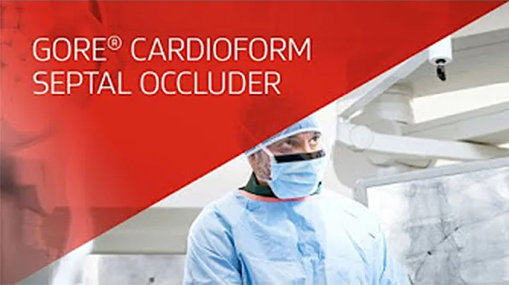 Reduction of Recurrent Strokes in Patients with PFO: Long-Term Outcomes