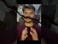 2 Year Consistency Challenge 🔥 | Codeforces After Contest Solution 🚀