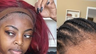 How To SAFELY & EASILY Remove Your Lace Wig Install