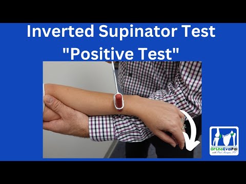 Inverted Supinator Test (Positive Test)