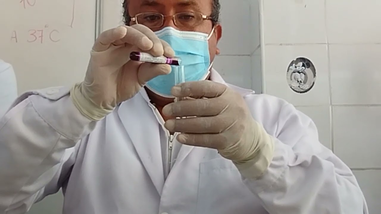 Presencia de sangre en heces. Examen o Test de Thevenon