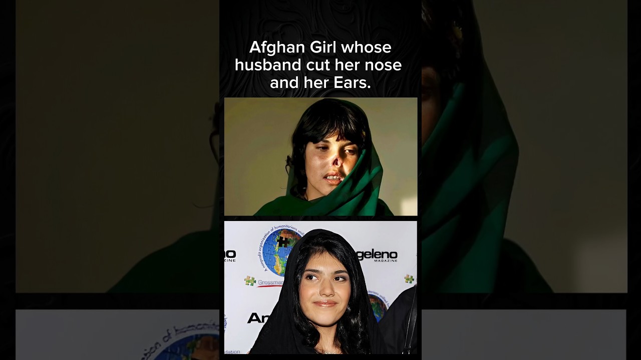 Story Of Afghan Girl 💔 