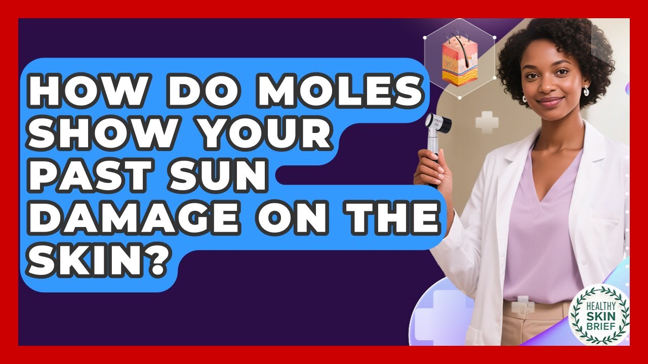 How Do Moles Show Your Past Sun Damage On The Skin? - Healthy Skin Brief