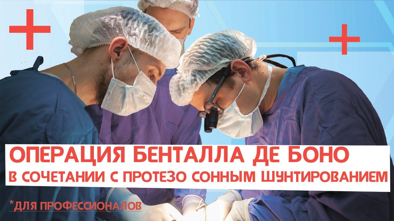 Операция Бенталла де Боно в сочетании с протезо-сонным шунтированием (для профессионалов)
