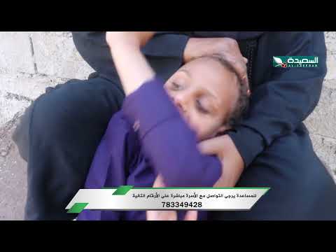 الطفل خالد ومعاناته من شلل بسبب ضمور في الدماغ
