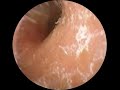 Proper Ear Care Routine | Learn & Relax
