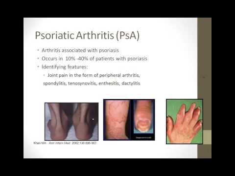 Living Well with Psoriatic Arthritis: What You Need to Know