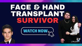 Joe DiMeo-World’s First Successful Face and Double Hand Transplant