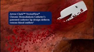 Vectorflow Chronic Hemodialysis Catheter