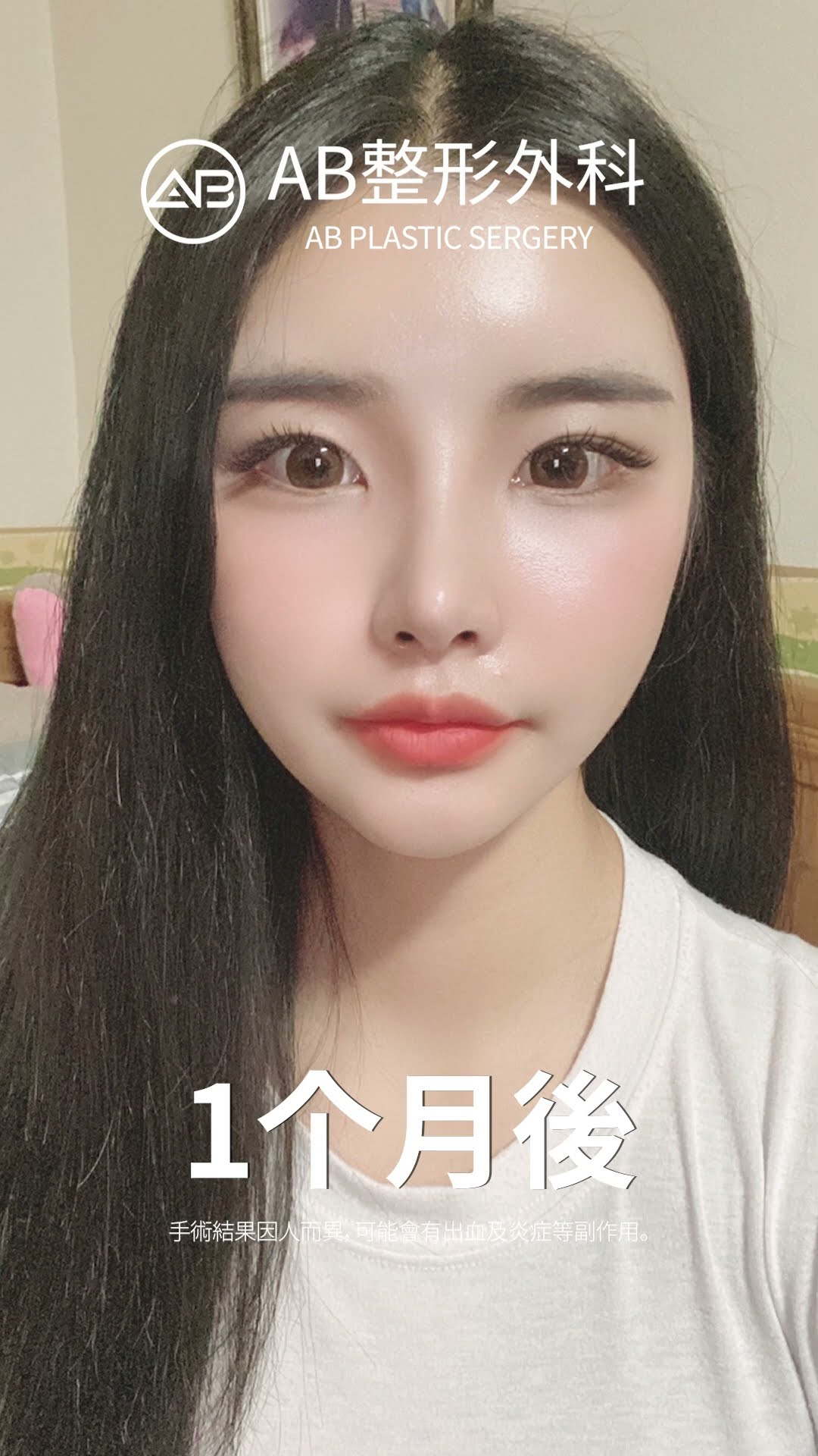 终极面部整形变身！#fyp #推荐